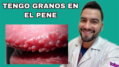 granos en el pené|Granos en el pene: 14 causas y cómo tratarlos